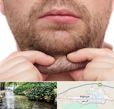 ساکشن غبغب در هرسین