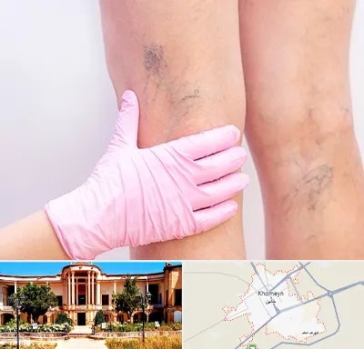 دکتر فوق تخصص واریس در خمین