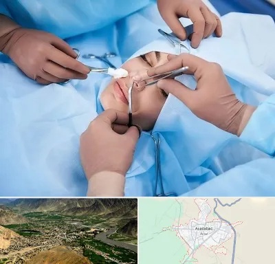 عمل بینی فانتزی در اسدآباد