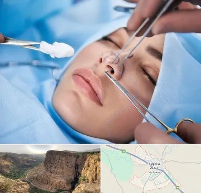 عمل ترمیمی بینی در سرپل ذهاب