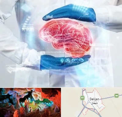 دکتر مغز و اعصاب در دلیجان