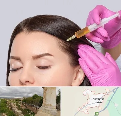 تزریق هیر فیلر در کنگاور
