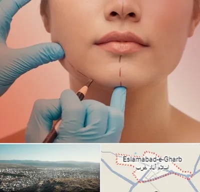 دکتر زیبایی خانم در اسلام آباد غرب