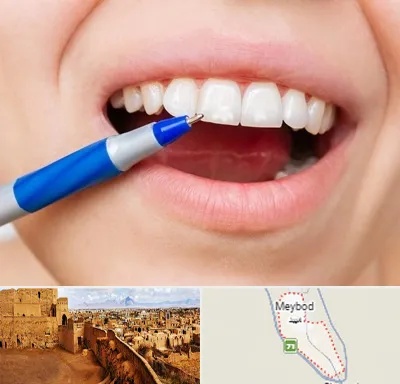 دندانسازی ارزان در میبد