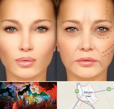 متخصص زیبایی چشم در دلیجان