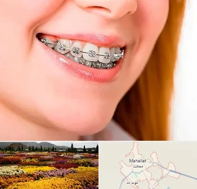 ارتودنسی ارزان در محلات