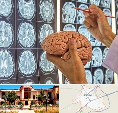 دکتر فوق تخصص جراح مغز و اعصاب در خمین