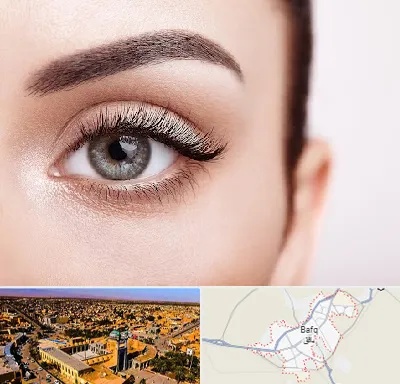 فوق تخصص عنبیه در بافق