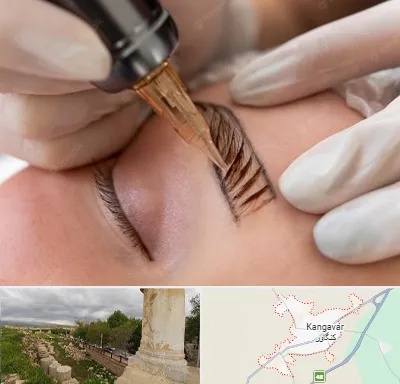 میکروبلیدینگ در کنگاور