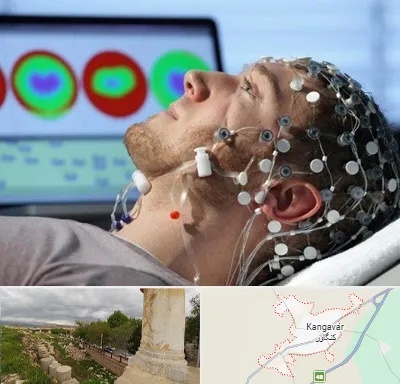 مرکز نوار مغز در کنگاور