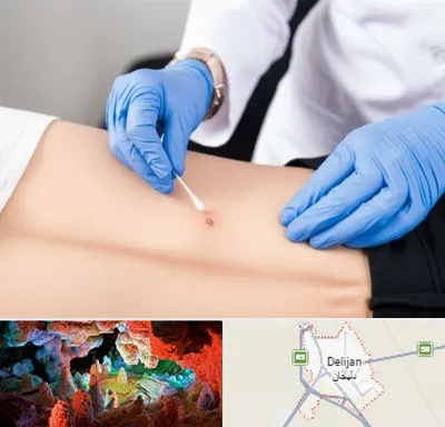 متخصص زخم بستر در دلیجان