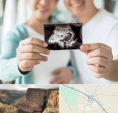 آزمایشگاه غربالگری در سرپل ذهاب