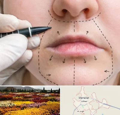 عمل سانترال لب در محلات