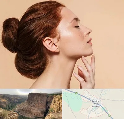 جراحی غبغب در سرپل ذهاب