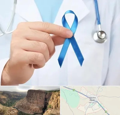 دکتر سرطان بیضه در سرپل ذهاب