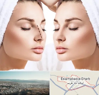 عمل بینی در اسلام آباد غرب