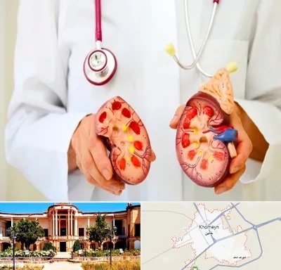 دکتر سنگ کلیه در خمین