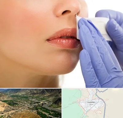 اپیلاسیون صورت در اسدآباد