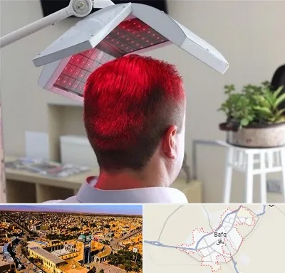کاشت مو با لیزر در بافق