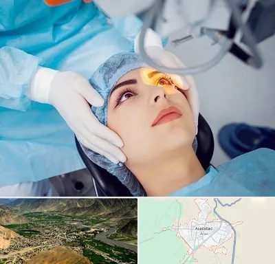 دکتر عمل لیزیک چشم در اسدآباد