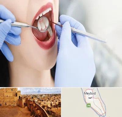 جراح دندان عقل در میبد