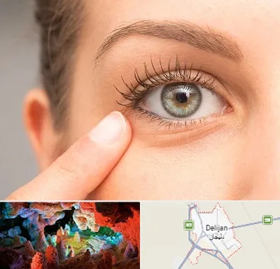 جراح پف چشم در دلیجان