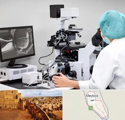 آزمایشگاه اسپرموگرام در میبد