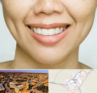 عمل چال گونه در بافق