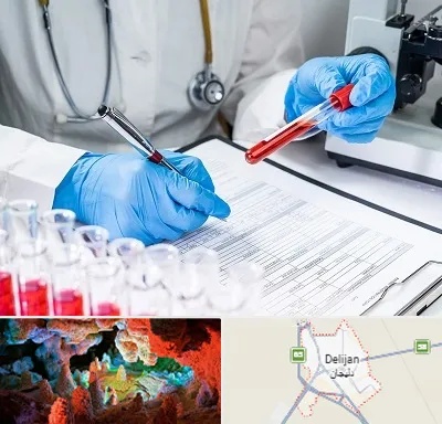 آزمایشگاه اعتیاد در دلیجان