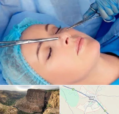 عمل بینی نیمه فانتزی در سرپل ذهاب