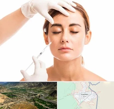 تزریق ژل گونه در اسدآباد