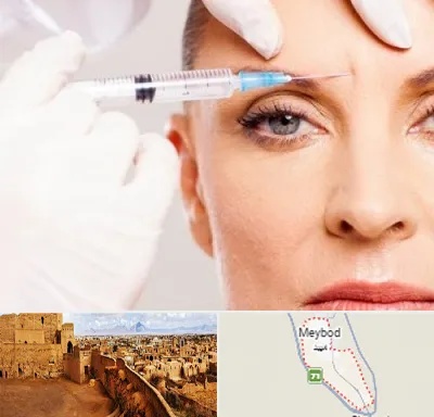 مزوژل در میبد
