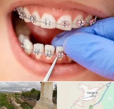 مرکز ارتودنسی دندان در کنگاور