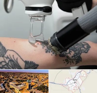 ریمو تاتو در بافق