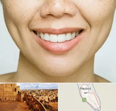 عمل چال گونه در میبد