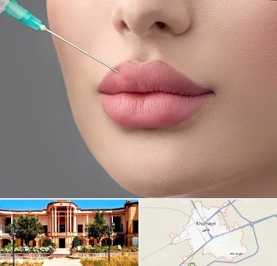 کلینیک ژل لب روسی در خمین