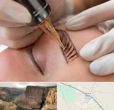میکروبلیدینگ در سرپل ذهاب