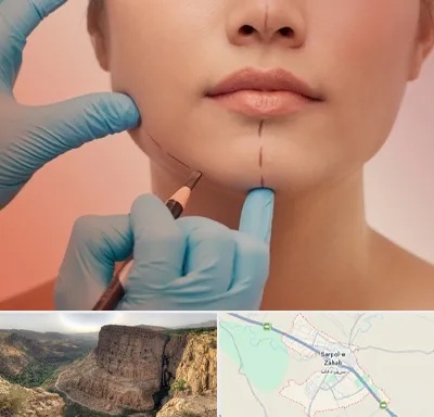 دکتر زیبایی خانم در سرپل ذهاب