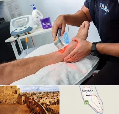 لیزر تراپی در میبد