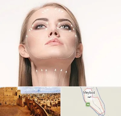 لیفت صورت با نخ در میبد