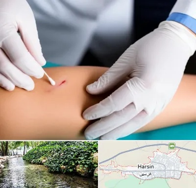 متخصص زخم عفونی در هرسین