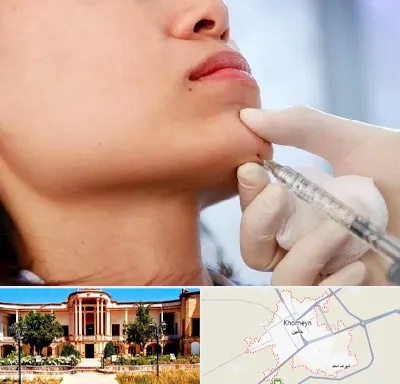زاویه سازی صورت در خمین