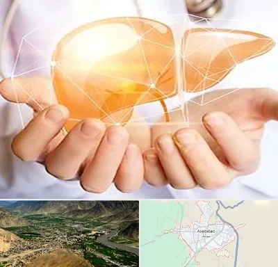دکتر سرطان کبد در اسدآباد