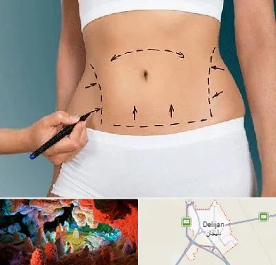 دکتر طب سنتی برای لاغری در دلیجان