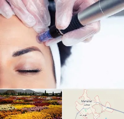 کلینیک مزوتراپی صورت در محلات