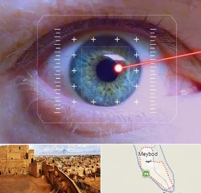 فمتولیزیک در میبد