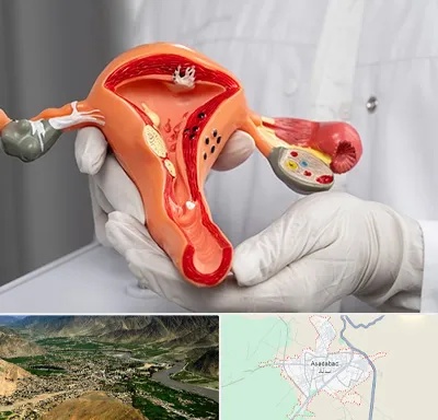 دکتر سرطان رحم در اسدآباد