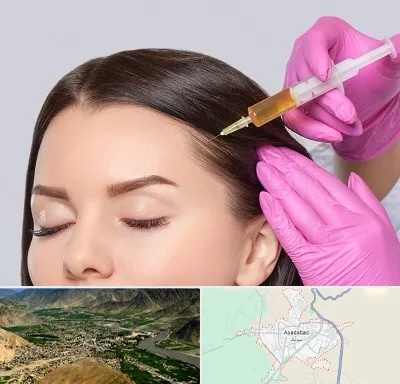تزریق هیر فیلر در اسدآباد
