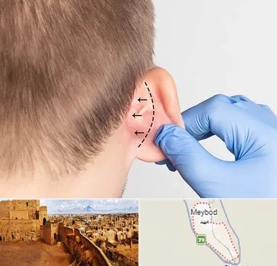 عمل زیبایی گوش در میبد