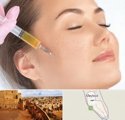 آموزش تزریق ژل و بوتاکس در میبد